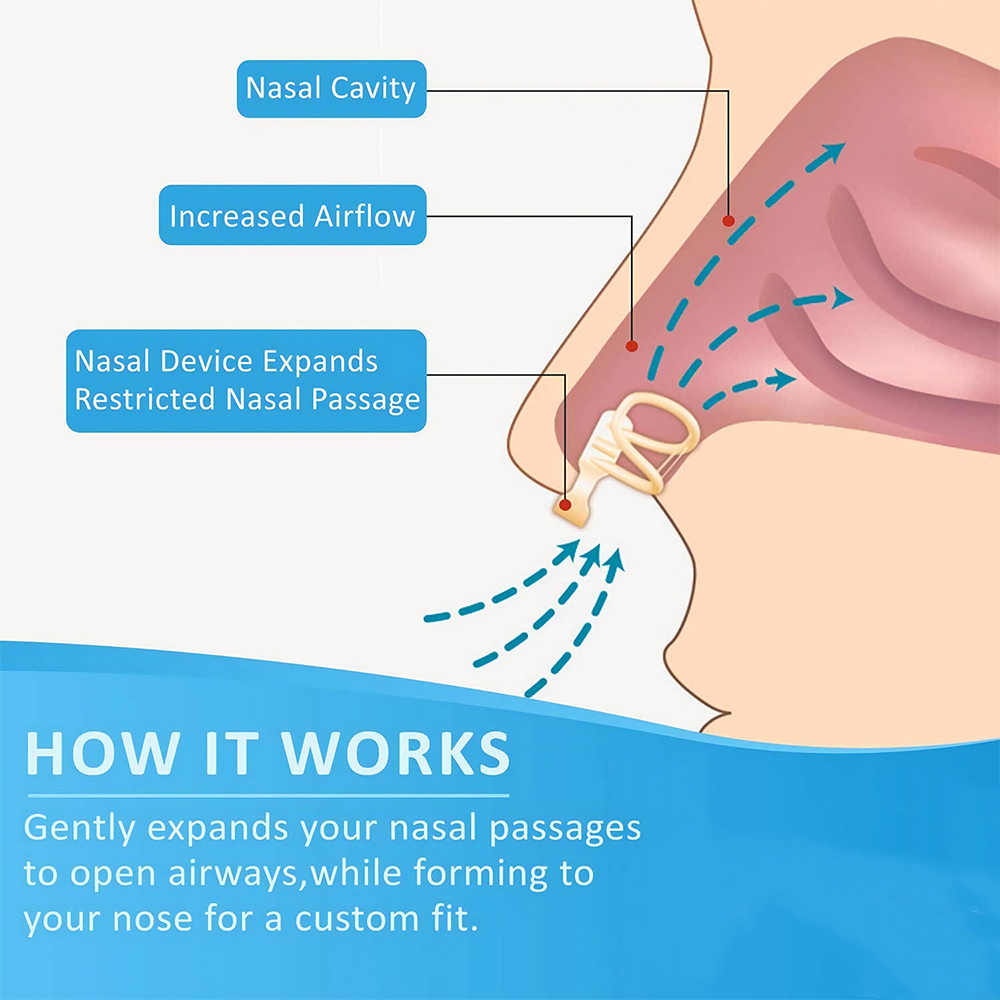 Rolha de ronco dilatador nasal - Anti Snore Contour Pillow avaliação e preço